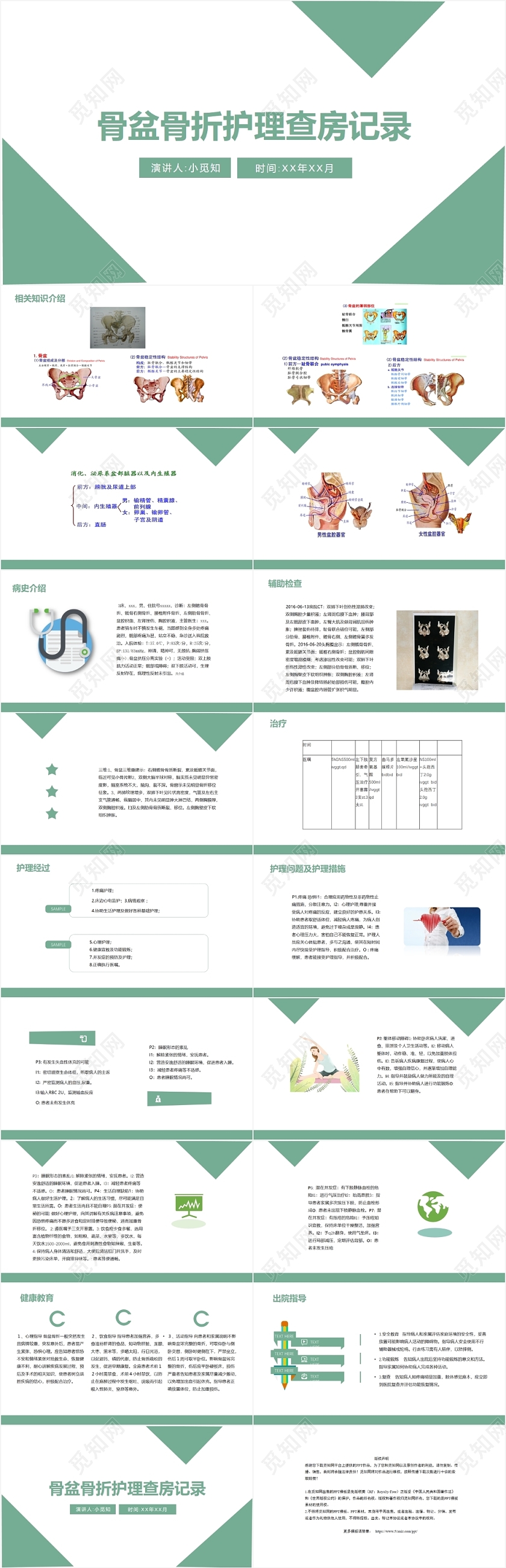 绿色实用简洁风骨盆骨折护理查房记录多发骨盆骨折护理查房PPT