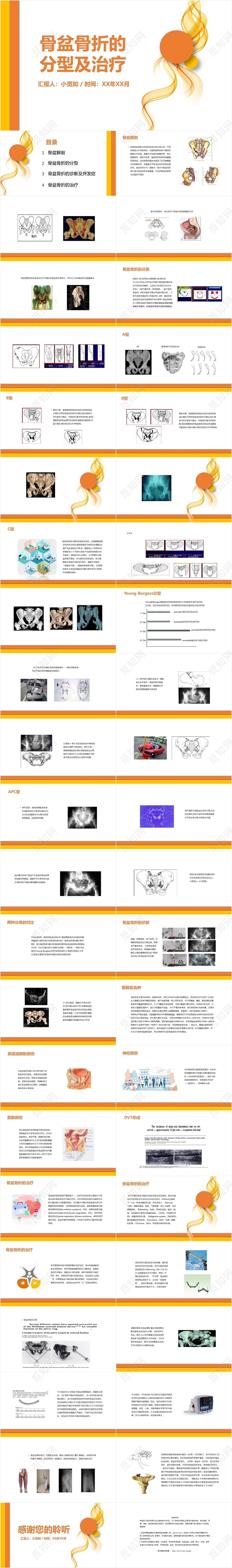 橙色曲线风骨盆骨折的分型及治疗多发骨盆骨折护理查房PPT模
