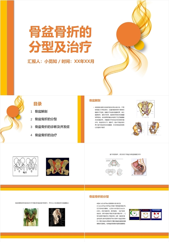 橙色曲线风骨盆骨折的分型及治疗多发骨盆骨折护理查房PPT模