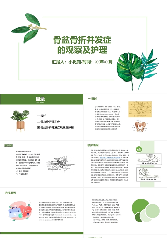 绿色热带植物风骨盆骨折并发症的观察及护理查房PPT模板多发骨盆骨折护理查房