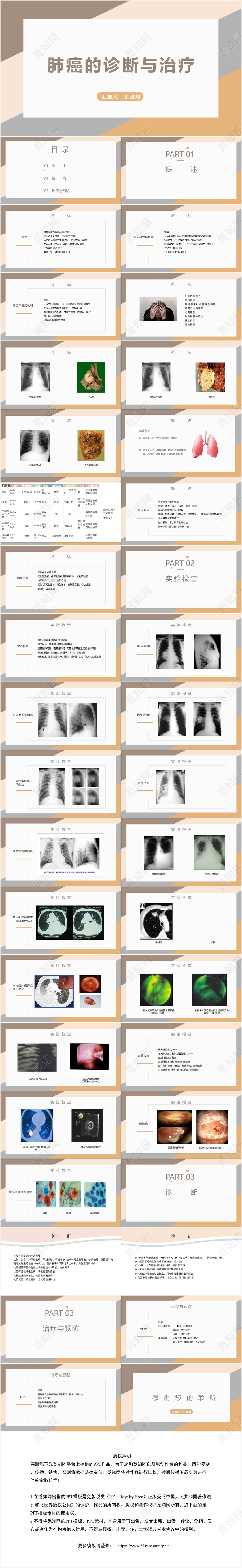 黄色简洁风肺癌的诊断与治疗肺癌护理查房PPT模板