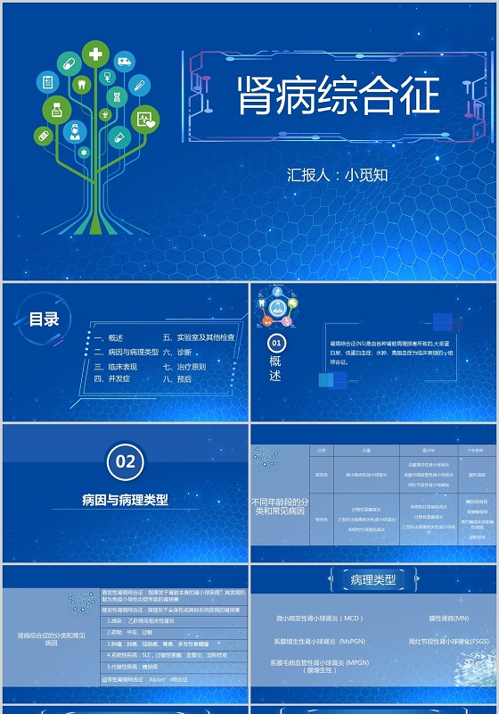 蓝色科技风肾病综合征PPT模板肾病综合征护理查房