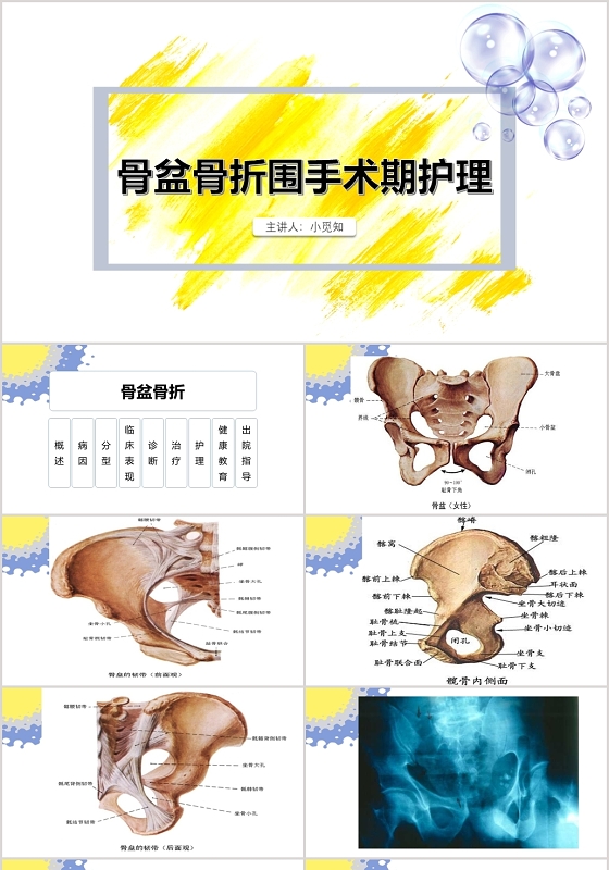 白色说课风课件多发骨盆骨折护理查房PPT模板