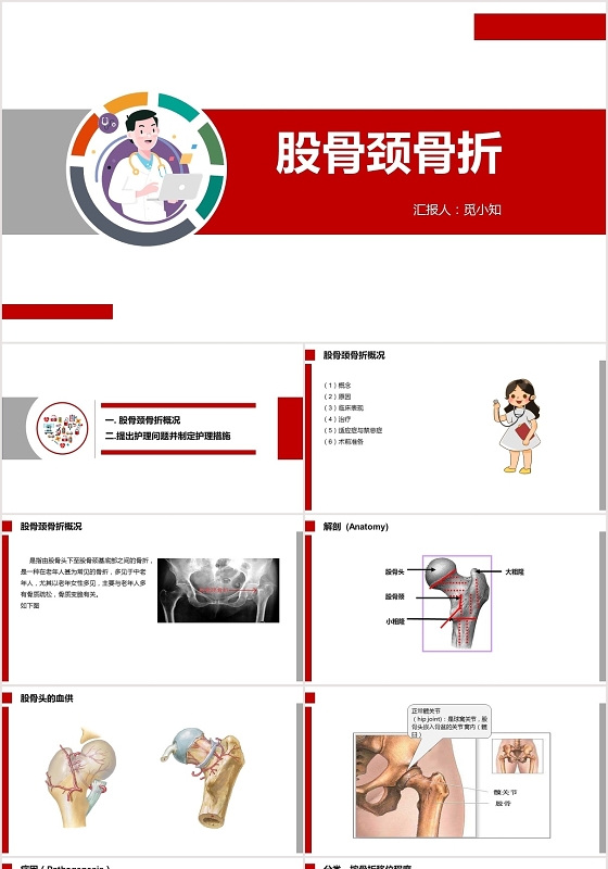 红色扁平股骨颈骨折护理查房股骨颈骨折PPT模板