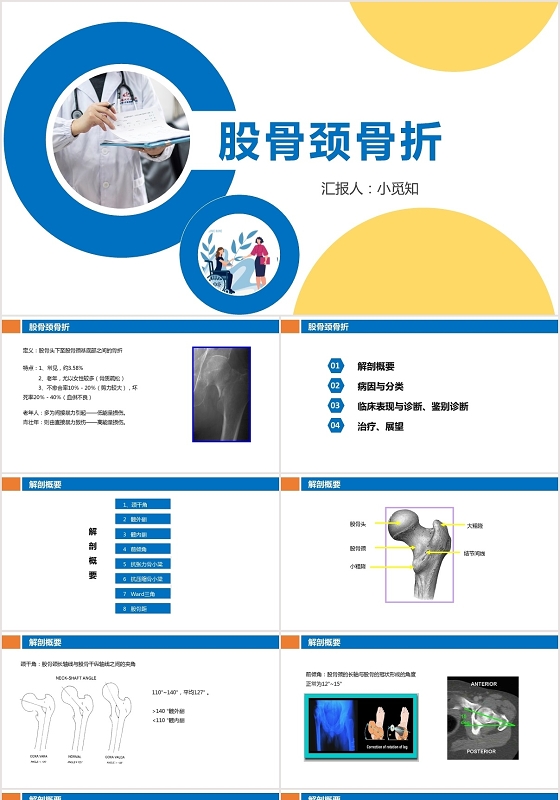 蓝色扁平股骨颈骨折护理查房股骨颈骨折PPT模板