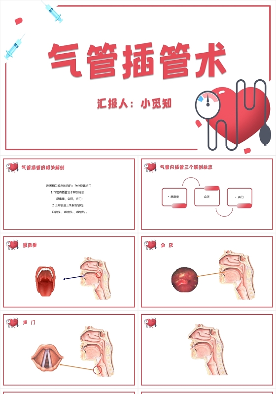 红色简约风气管插管术气管插管的护理PPT模板气管插管的护理ppt