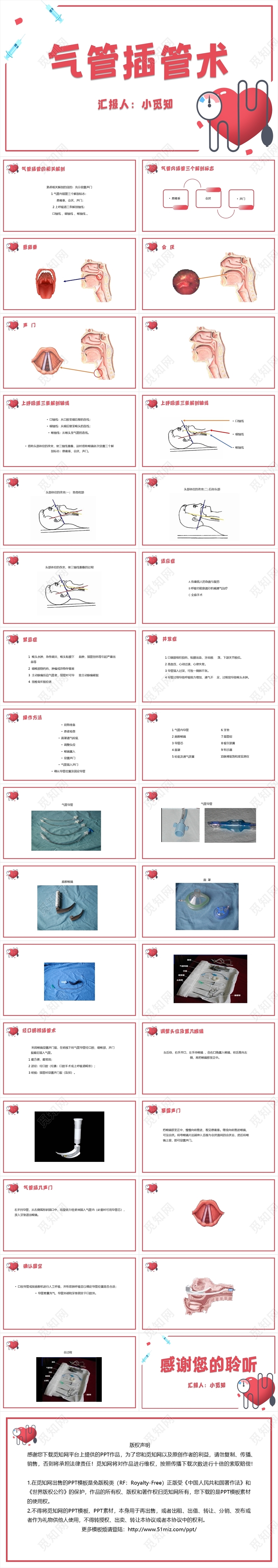 红色简约风气管插管术气管插管的护理PPT模板气管插管的护理ppt
