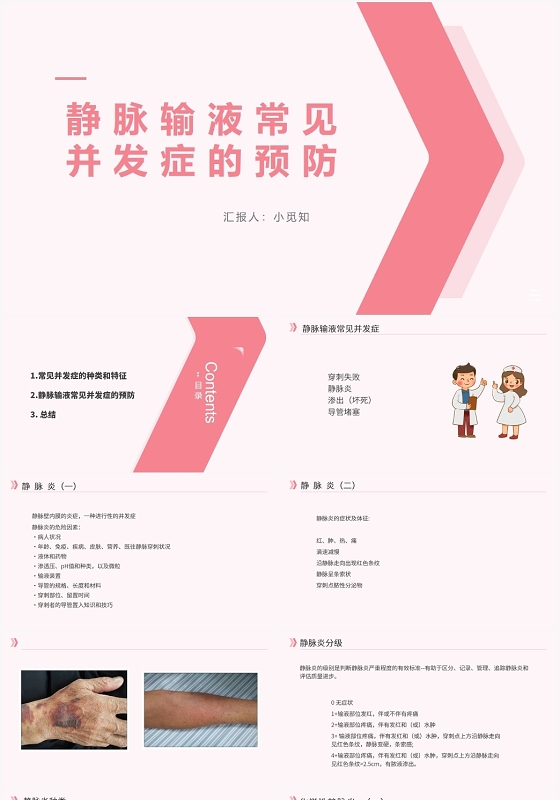 粉色简约风静脉输液静脉输液常见并发症的预见PPT模板