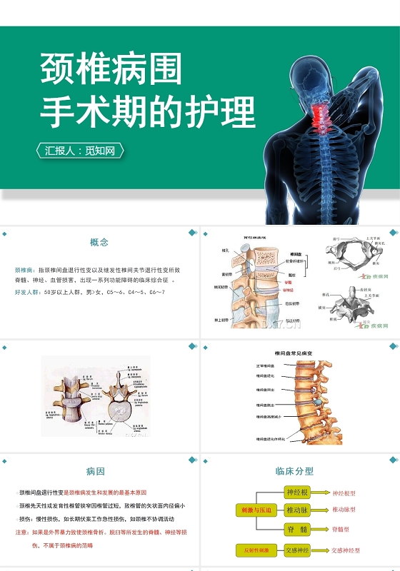 蓝色颈椎病围手术期的护理查房治疗PPT