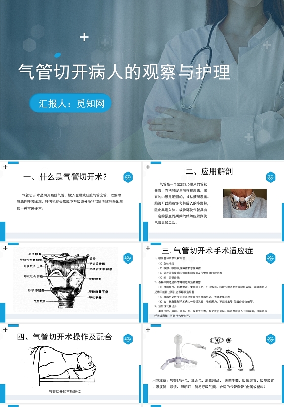 蓝色简约风气管切开病人的观察和护理PPT模板气管切开护理查房