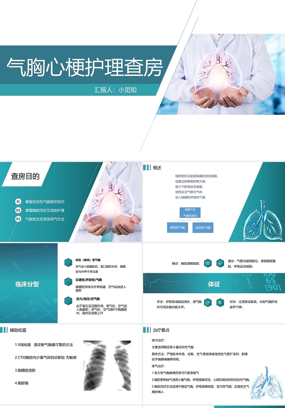 蓝色简约风气胸的护理查房PPT模板护理查房气胸患者