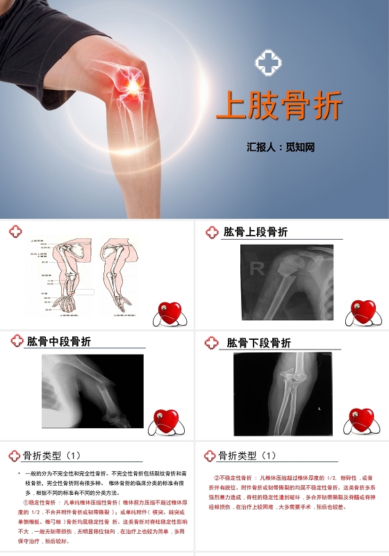 红色骨折上肢骨折护理查房
