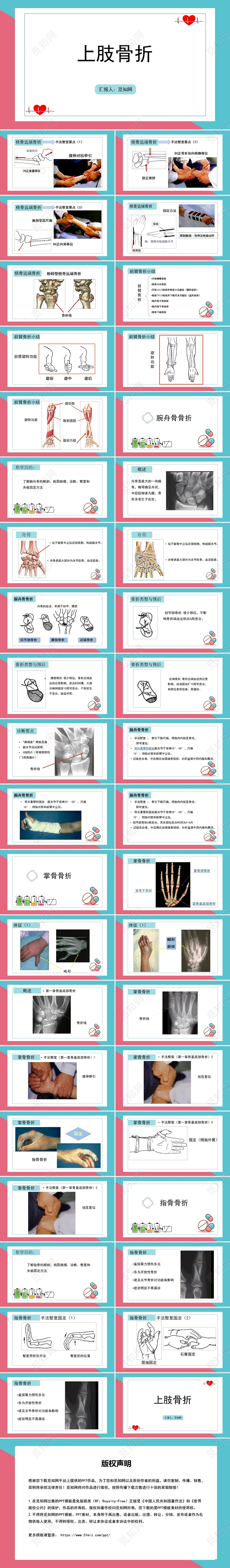 粉色骨折上肢骨折护理查房