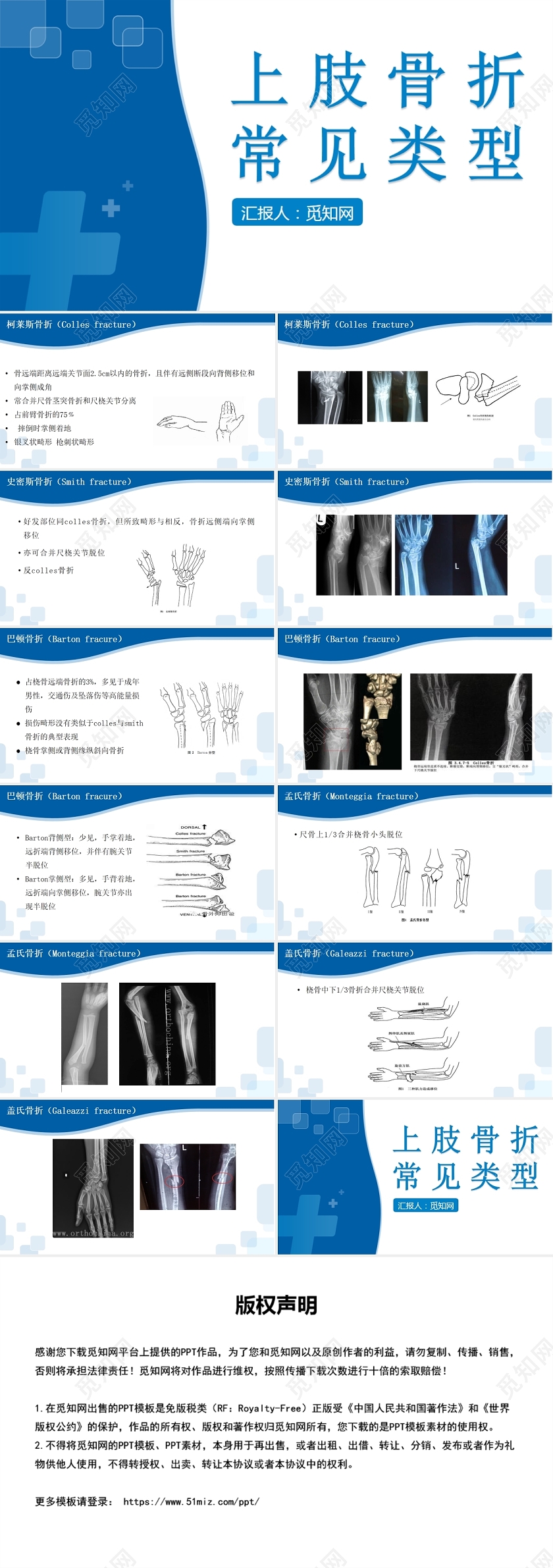 蓝色上肢骨折常见类型上肢骨折护理查房
