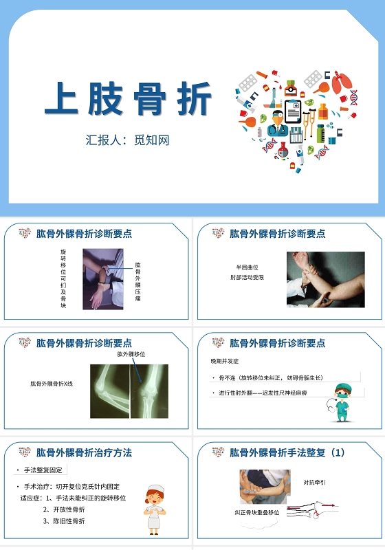 白色背景上肢骨折护理查房