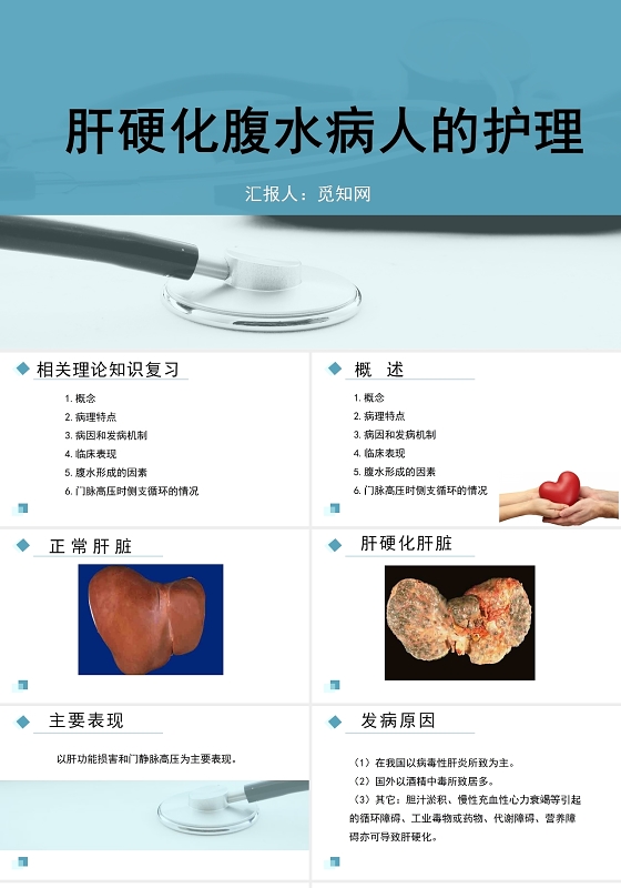 蓝色简约风肝硬化腹水病人的护理PPT模板肝硬化患者护理查房