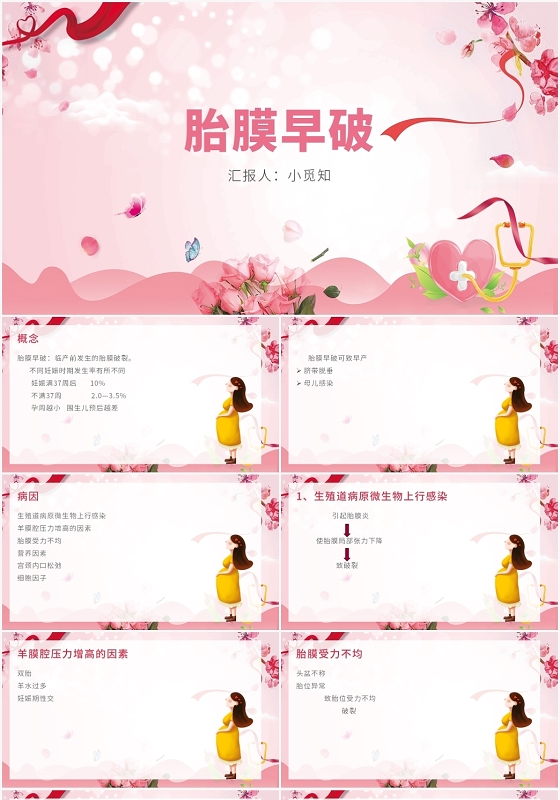 粉色卡通风胎膜早破护理查房胎膜早破PPT模板