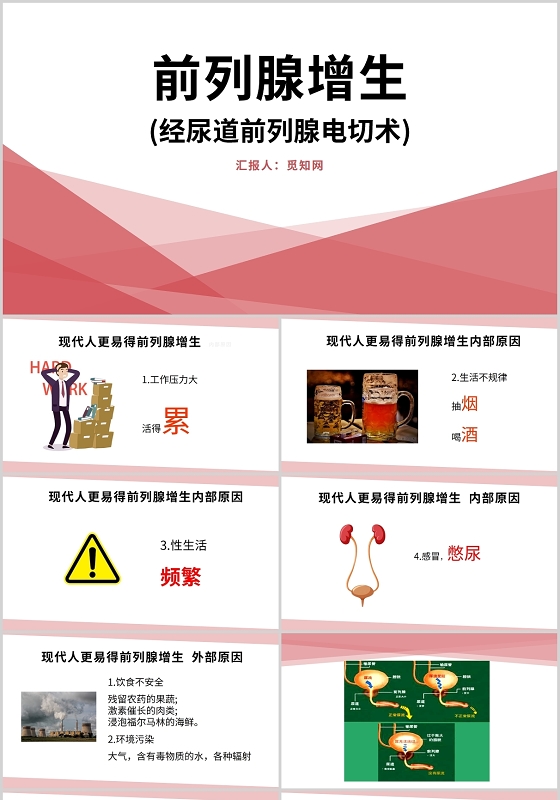 红色简约风前列腺增生医疗护理PPT模板前列腺电切护理查房