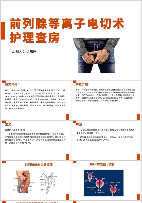 橙色前列腺电切护理查房