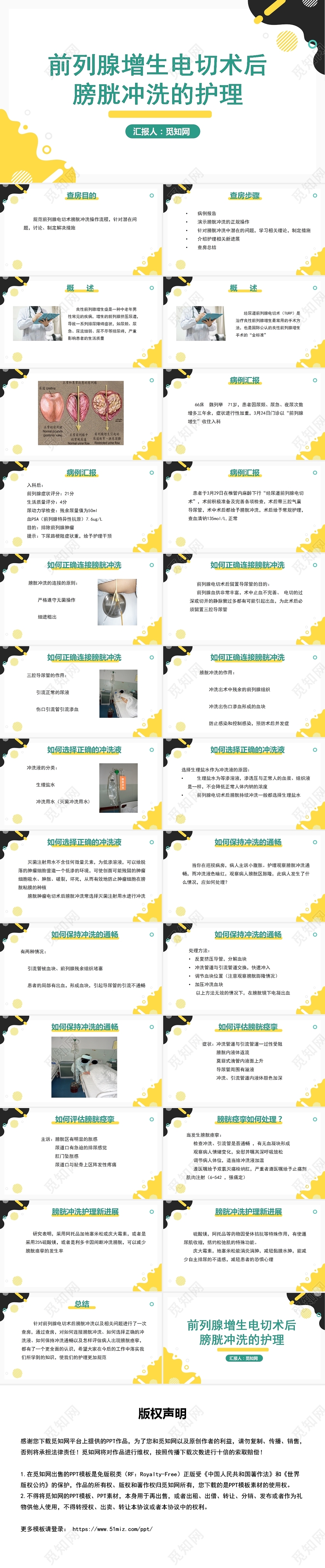 黄色简约风前列腺增生电切术后膀胱冲洗的护理PPT模板前列腺电切护理查房