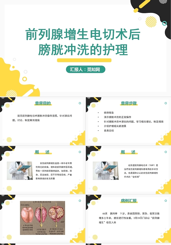 黄色简约风前列腺增生电切术后膀胱冲洗的护理PPT模板前列腺电切护理查房