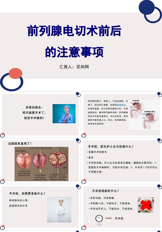 粉色前列腺电切护理查房