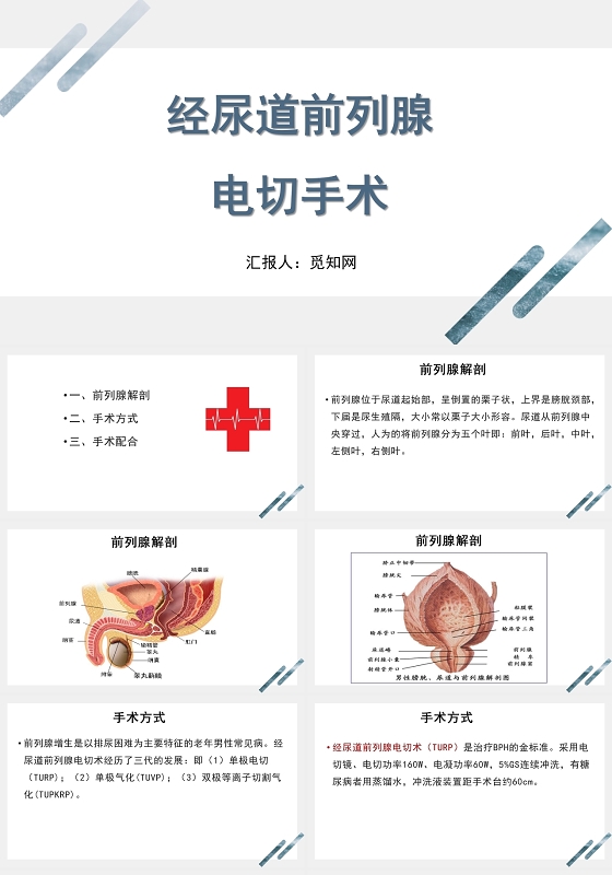 蓝色简约风经尿道前列腺电切手术医疗护理PPT模板前列腺电切护理查房