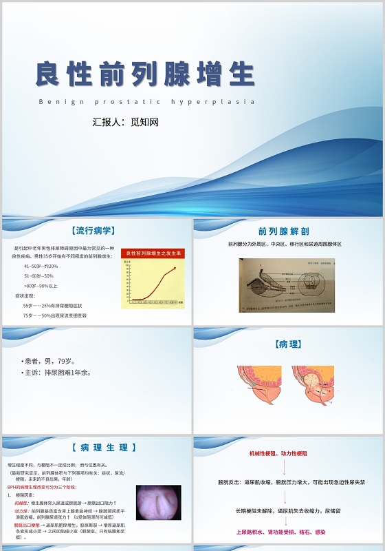 蓝色护理查房良性前列腺增生护理查房前列腺增生