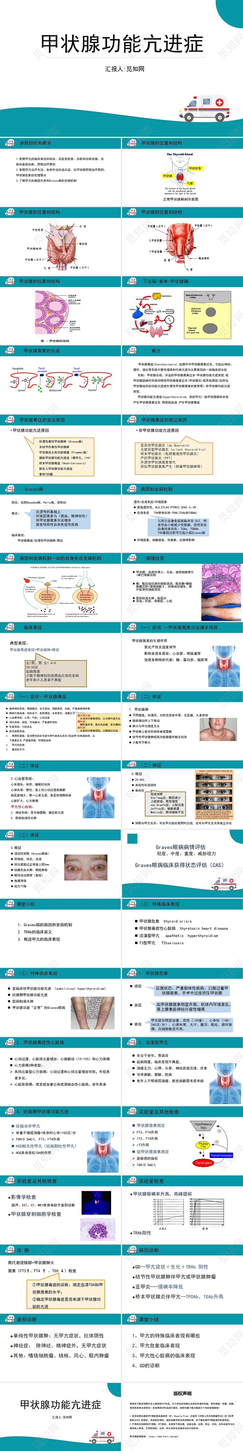 蓝色简约风甲状腺功能亢进症医疗护理PPT模板甲亢危象护理查房