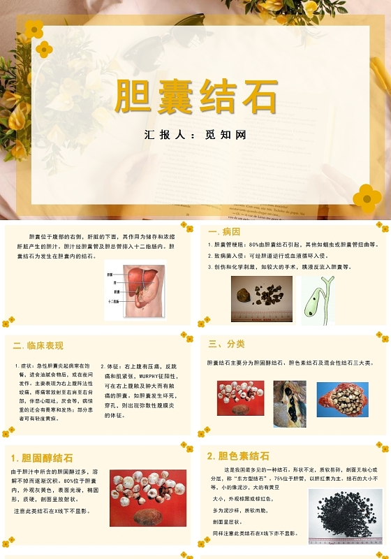 黄色胆囊结石护理查房