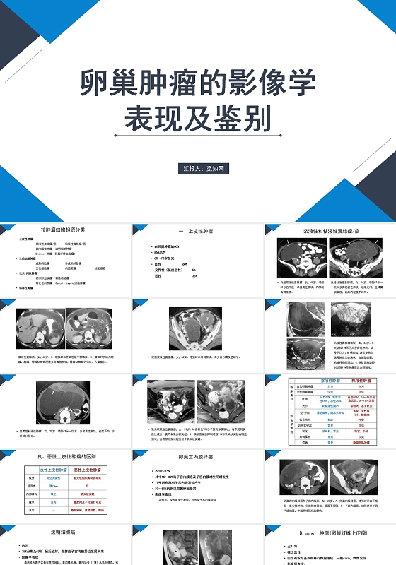 蓝色商务风卵巢癌护理查房PPT模板