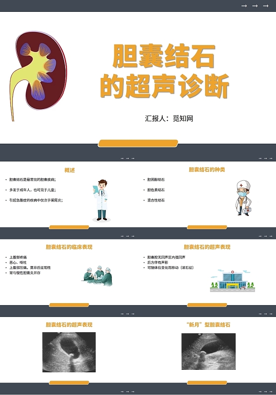 黄色简约风胆囊结石的超声诊断PPT模板胆囊结石护理查房