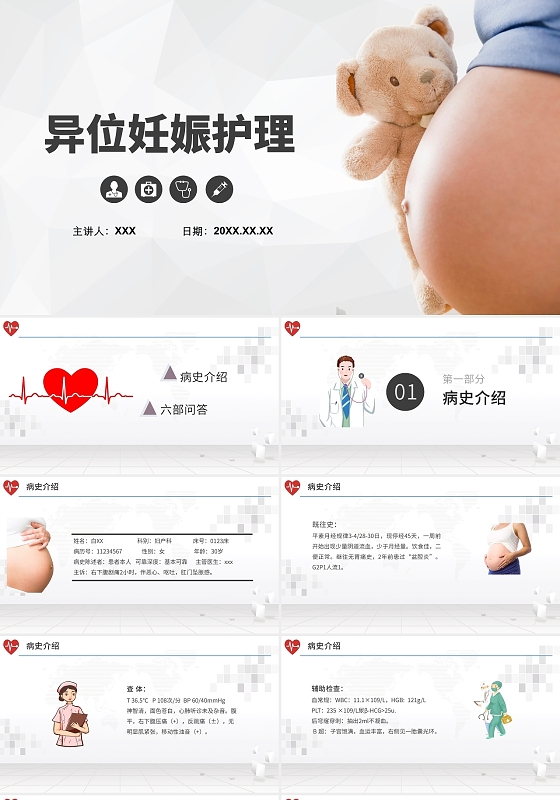 白色简约异位妊娠护理医疗PPT模板异位妊娠护理查房