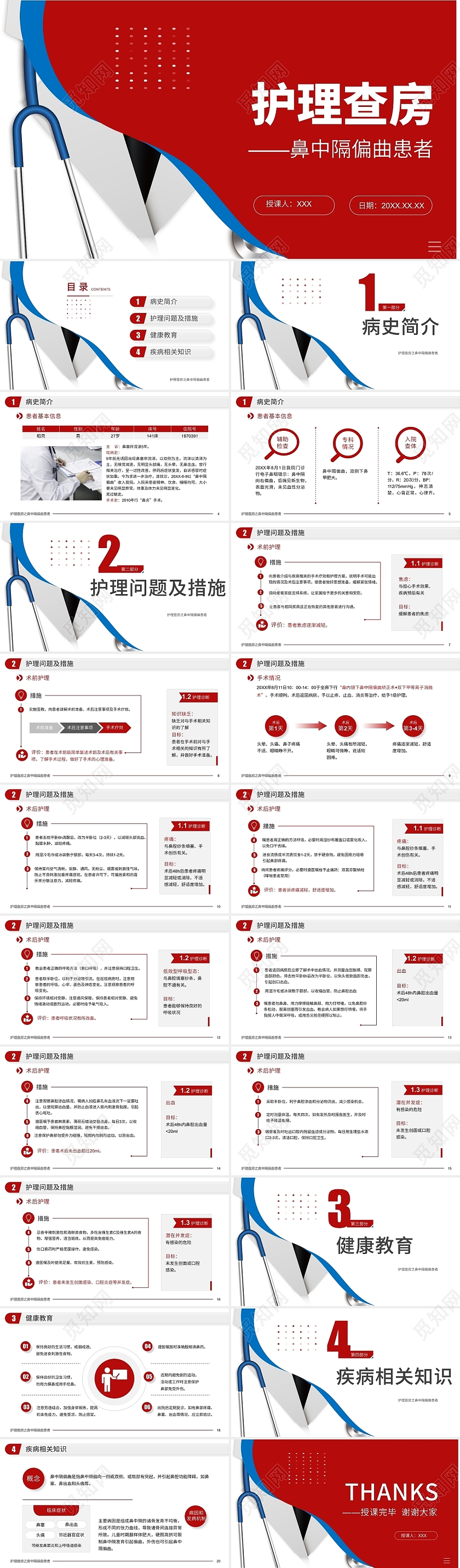 红色简约鼻中隔偏曲患者护理查房PPT模板鼻中隔偏曲护理查房