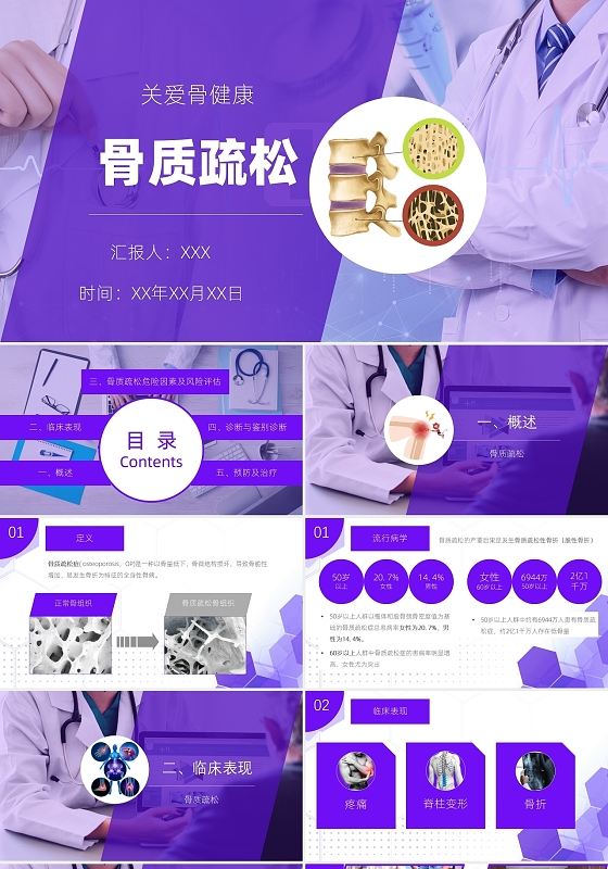 蓝白色简约骨质疏松医疗汇报健康知识培训PPT
