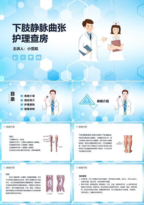 蓝色简约下肢静脉曲张护理查房PPT模板宣传PPT动态PPT下肢静脉曲张的护理查房