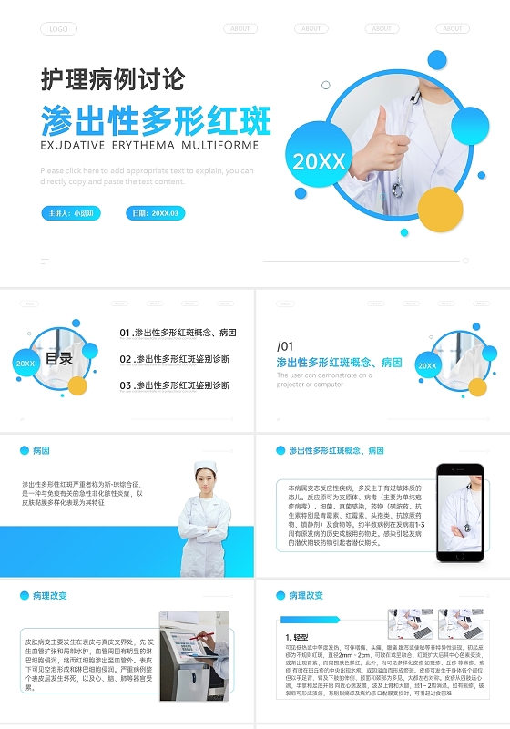 蓝色渐变图形商务渗出性多形红斑护理病例讨论PPT模板