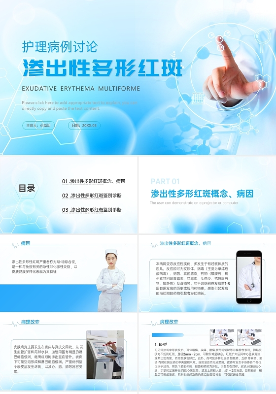 蓝色科技感渐变渗出性多形红斑护理病例讨论医疗通用PPT