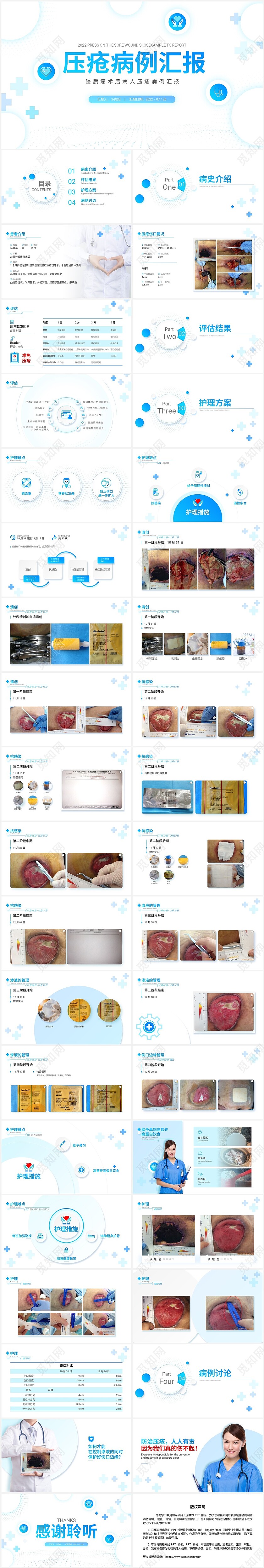 医疗蓝微立体医院病例工作汇报PPT压疮病例汇报