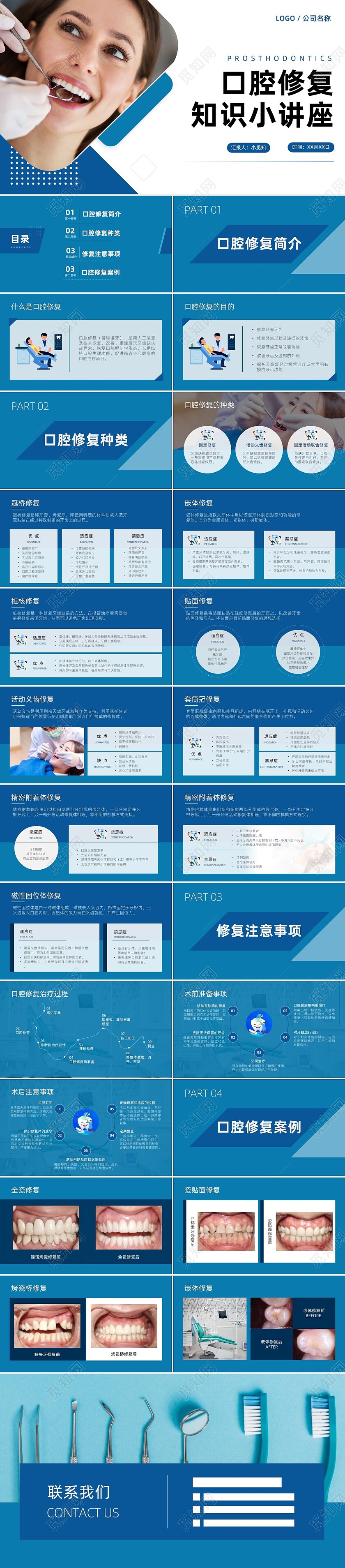 蓝色简约医学学术口腔修复镶牙龋齿治疗知识PPT口腔修复相关知识