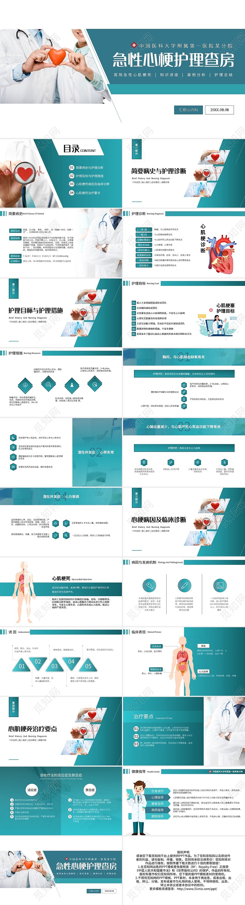 蓝色简约急性心梗护理查房PPT模板宣传PPT动态PPT