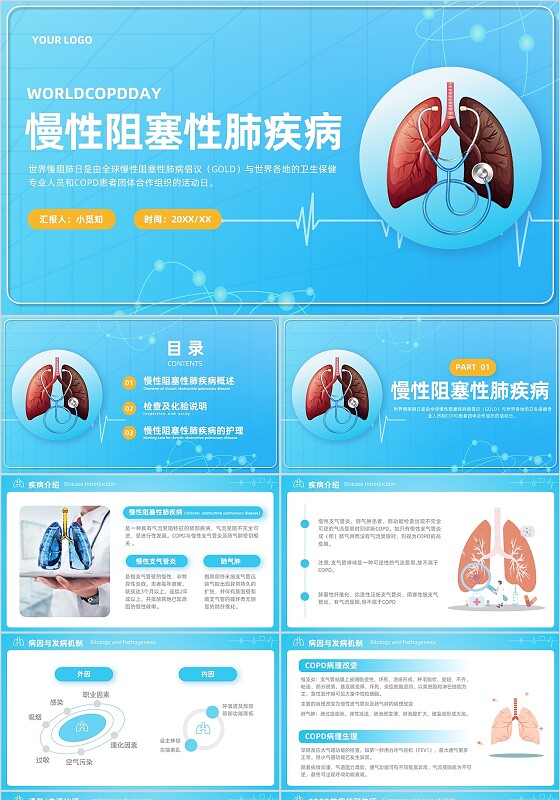 蓝色商务简约风慢性病概述及肺病医疗健康通用PPT护理查房
