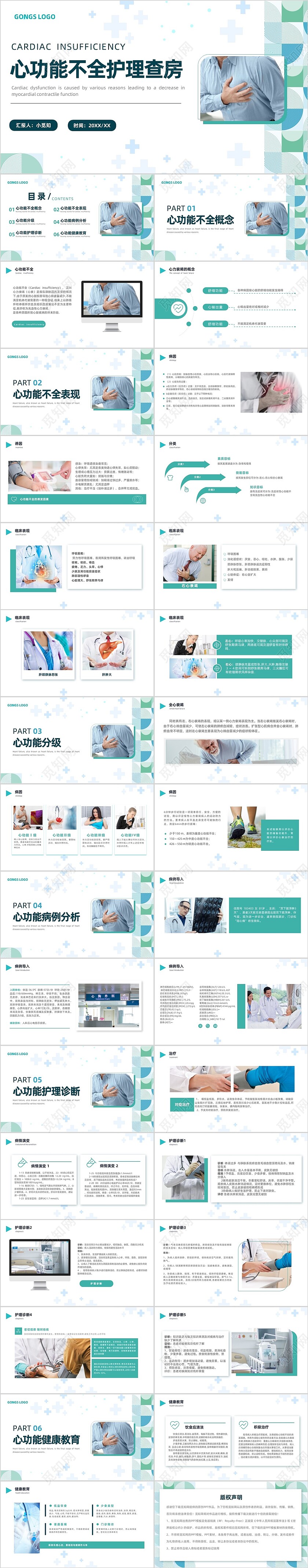 心功能不全护理查房医疗健康绿色简约商务通用PPT