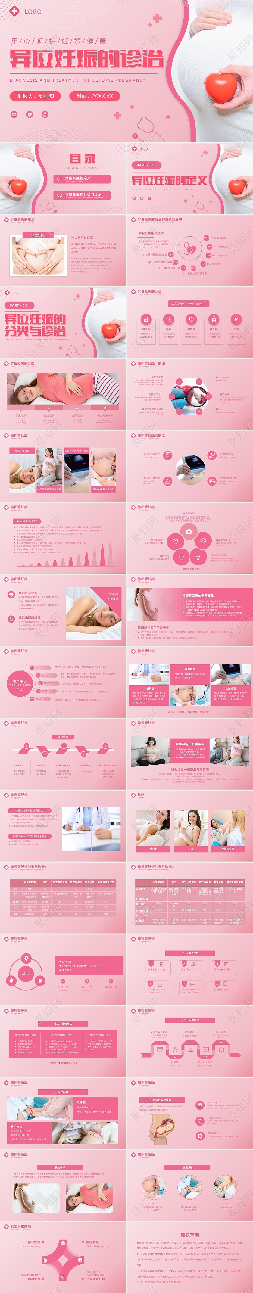 粉色实拍风异位妊娠的诊治医疗健康母婴孕妇培训PPT
