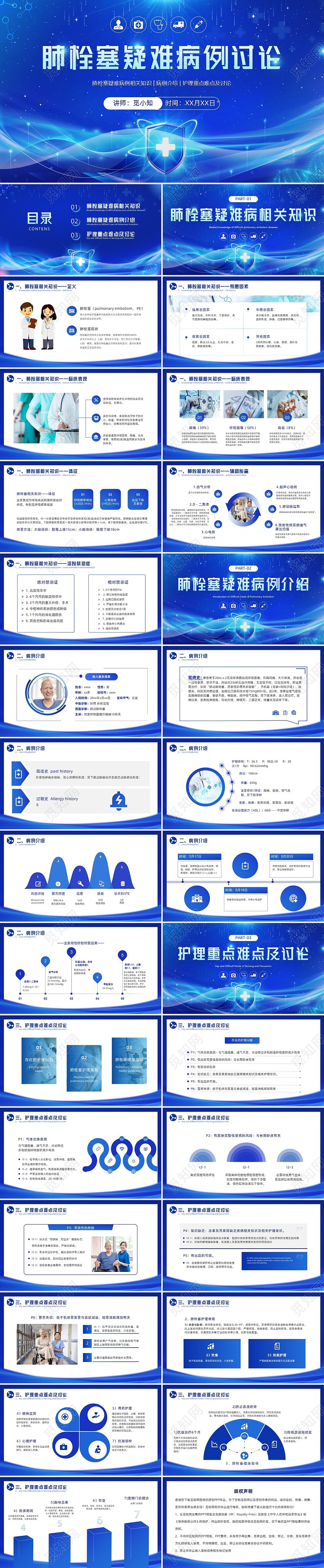 蓝色科技感医疗肺栓塞疑难病例讨论护理护士培训PPT