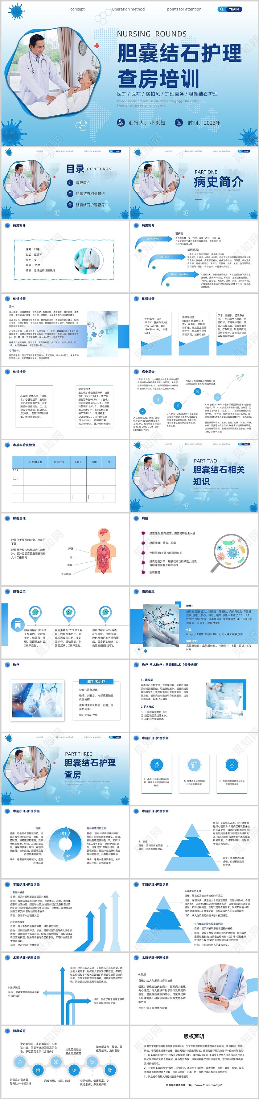 胆囊结石护理查房实拍商务PPT