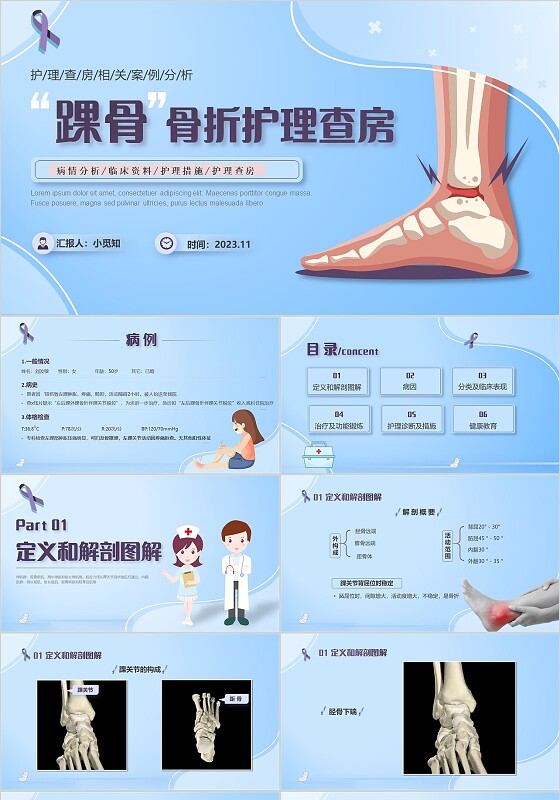 蓝紫色医疗风踝关节骨折护理查房护理PPT模板pptx