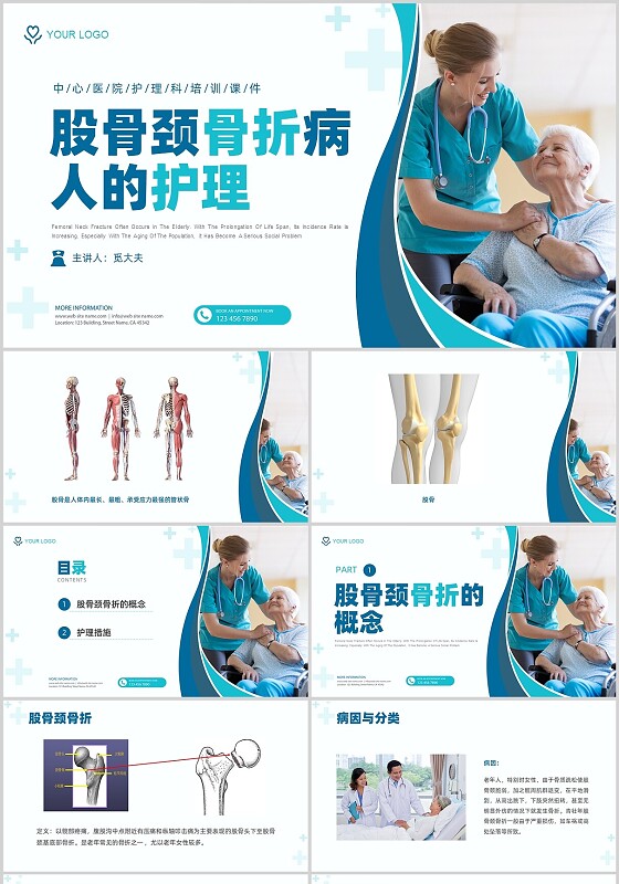 绿色实拍医疗护理培训股骨骨折护理查房培训PPT课件