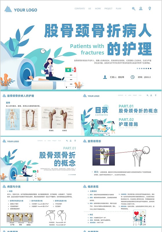 蓝色简约风股骨颈骨折护理查房培训课件