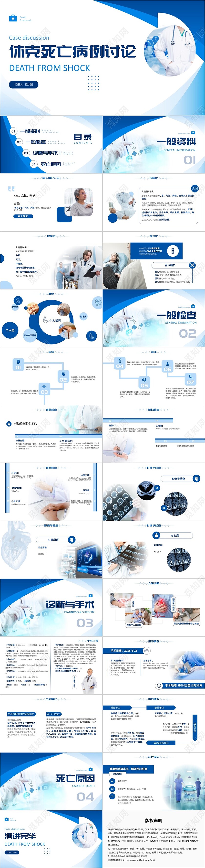 蓝色实拍风简约风休克死亡病例讨论PPT